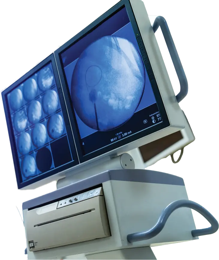 In Vitro Fertilization (IVF)